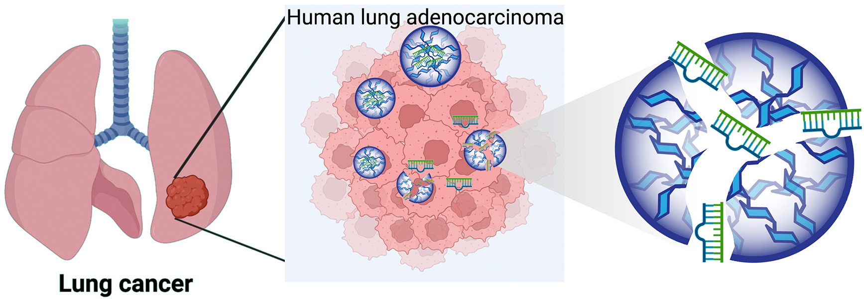 “Anticancer activity of NFκB decoy oligonucleotide-loaded nanoparticles against human lung cancer” V. K. Kannaujiya, G. De Rubis, K. R. Paudel, B. Manandhar, D. K. Chellappan, S. K. Singh, R. MacLoughlin, G. Gupta, D. Xenaki, P. Kumar, P. M. Hansbro, B. G. G. Oliver, P. R. Wich, K. Dua J. Drug Delivery Sci. Technol. 2023, 82, 104328. (DOI: 10.1016/j.jddst.2023.104328)